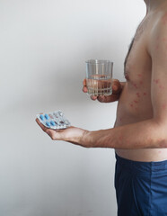 Red itchy rash covers a mans body as he holds water and pills for internal treatment of acne and allergies.