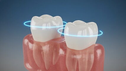 The two molars tooth in inflamed gums with blue energy arcs showing nerve pain and tooth decay or sensitivity in close medical view