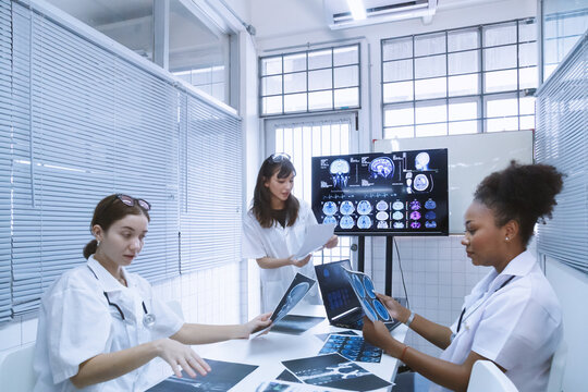 young female doctor student internship team group meeting and discussing about brain cancer surgery treatment patient case at the lab office in hospital. healthcare and medical education concept.