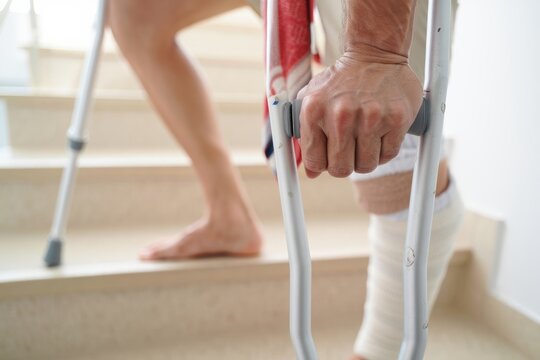 Person using crutches to navigate stairs, highlighting mobility challenges