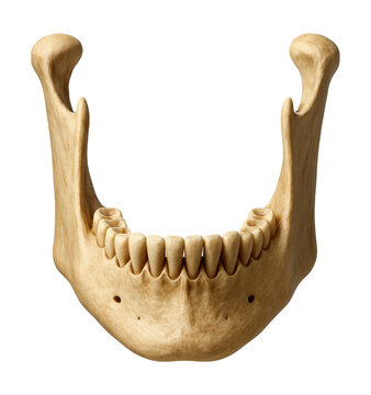 Mandible featuring a prominent ramus and sockets for tooth attachment.