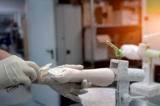 Experienced technician carefully shapes the prosthetic limb using a cutting instrument in a well-lit clinic. The focus is on ensuring a perfect fit, paying particular attention to detail. - Powered by Adobe