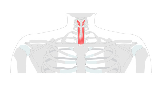 Sternohyoid Thyrohyoid - Human infrahyoid muscle shown in anatomy diagram responsible for depressing the hyoid bone, aids in swallowing and speech, medical reference and cervical region education.