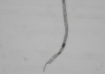 soil microorganisms under a microscope including amoeba, flagellates, nematodes, fungi, bacteria	
