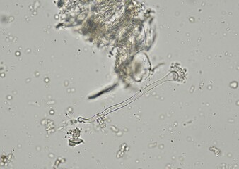 soil microorganisms under a microscope including amoeba, flagellates, nematodes, fungi, bacteria	
