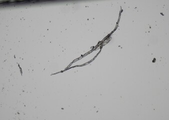 soil microorganisms under a microscope including amoeba, flagellates, nematodes, fungi, bacteria	
