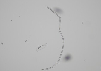 soil microorganisms under a microscope including amoeba, flagellates, nematodes, fungi, bacteria	
