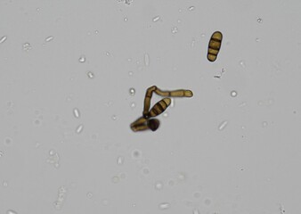 soil microorganisms under a microscope including amoeba, flagellates, nematodes, fungi, bacteria	

