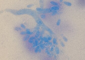 soil microorganisms under a microscope including amoeba, flagellates, nematodes, fungi, bacteria	
