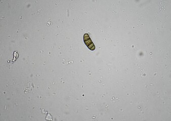 soil microorganisms under a microscope including amoeba, flagellates, nematodes, fungi, bacteria	
