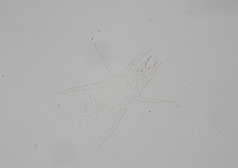 soil microorganisms under a microscope including amoeba, flagellates, nematodes, fungi, bacteria	
