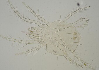 soil microorganisms under a microscope including amoeba, flagellates, nematodes, fungi, bacteria	
