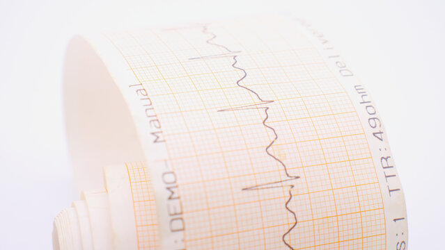 heart on the cardiogram