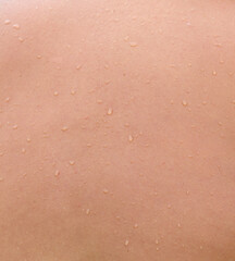 A person's back with water droplets on it