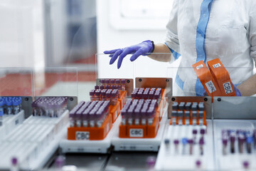 laboratory for research of tests, the doctor loads into the research device
