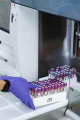 laboratory for research of tests, the doctor loads into the research device