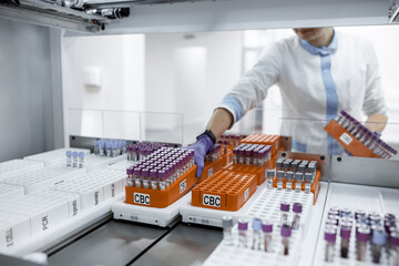 laboratory for research of tests, the doctor loads into the research device