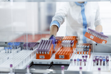 laboratory for research of tests, the doctor loads into the research device