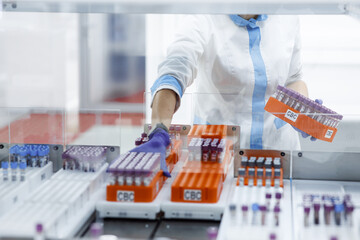 laboratory for research of tests, the doctor loads into the research device