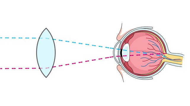convex lens eye focusing light on retina accommodation vision science animation