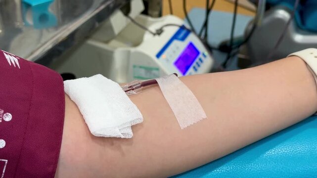 Close Up Shot Of female hand Blood Donor With an Attached Catheter. Donation For Organ Transplant Patients.