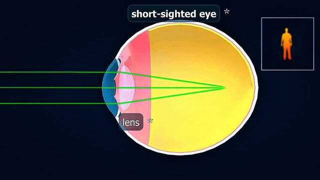 Sort sigted object -distant object