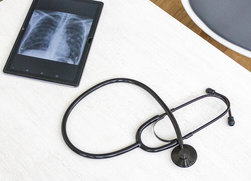 Table with phonendoscope, and a X ray image of the lungs with pneumonia on the tablet. healthcare