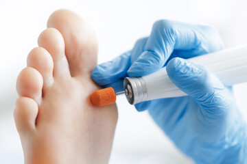 Podiatrist treating patient foot with medical drill in clinic
