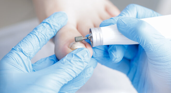 Professional podiatrist care for foot health and toenail treatment