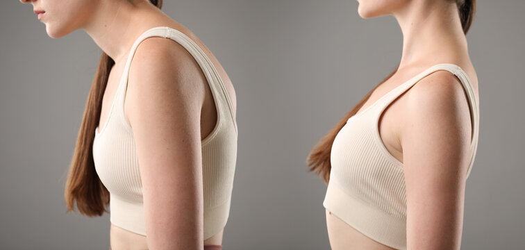 Before and after collage showing woman with good and bad posture against grey background, closeup