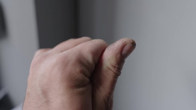 A male hand with rough, dirty skin and damaged nails from hard manual labor. Concept of physical work, endurance, and occupational health