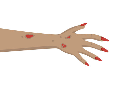 Zombie Hand with Scratches and Long Nails, Vector Illustration. Creepy Halloween Zombie Hand. Scary Undead Arm for Horror Design, Costume Party, Poster, Halloween Decor