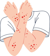 Minimal flat illustration showing a person with crossed arms covered by red rash spots, useful for healthcare, dermatology, allergy, or infection awareness content