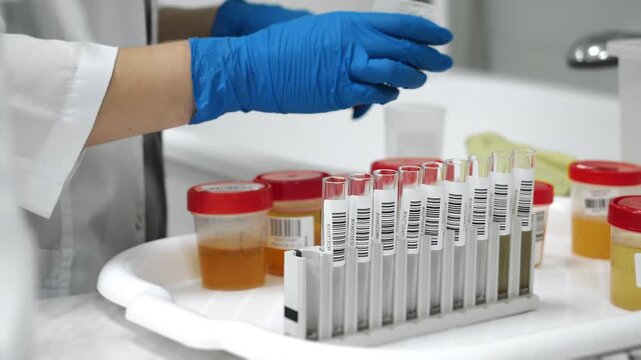 Medical laboratory worker in blue gloves pouring urine samples into test tubes for clinical diagnostics and laboratory analysis in modern healthcare lab.