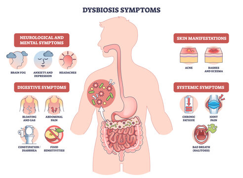 Dysbiosis symptoms visual shows gut imbalance across body, human silhouette with intestines and bacteria icons highlights digestive, skin, mental signs, transparent background.