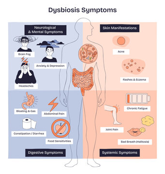 Dysbiosis symptoms mapped, gut microbiome imbalance linking digestive, skin, and mental signs, key visuals include intestines, human silhouette, and symptom icons, transparent background.