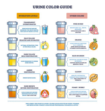 Urine color guide shows a hydration chart with sample cups and color scale, explaining meanings from transparent to dark brown and other hues for health cues, transparent background.