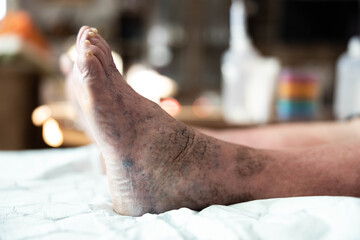A detailed view of an elderly foot shows skin texture and markings, highlighting the natural aging process while emphasizing the importance of foot care for overall well-being and mobility.