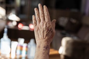 An aged hand extended upward, capturing the gentle light, symbolizing the strength and grace found in elderly individuals as they embrace their life experiences and wisdom.