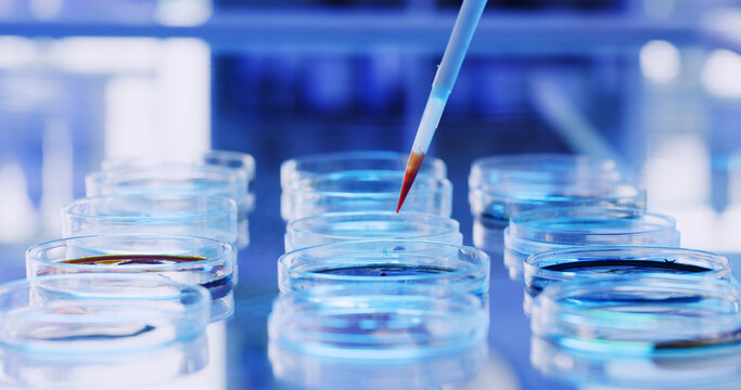 Medical, pipette or liquid in lab with petri dish, biotechnology or blood test for vaccine development. Science, dna exam or expert in clinic with sample, research or analysis in pharmaceutical study