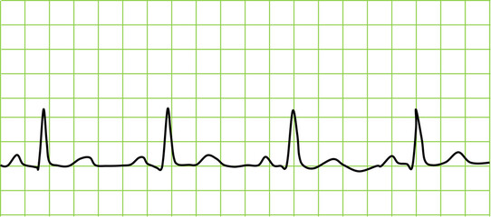 心電図のグラフィック素材イラスト