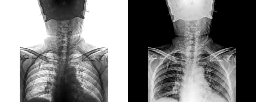Neck Anterior Projection X-Ray Radiograph Depicting Cervical Spine Bones for Assessment and Spinal Integrity Isolated on Transparent Background