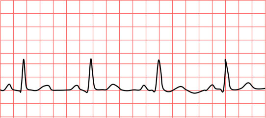 Naklejka premium 心電図のグラフィック素材イラスト