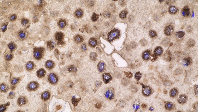Parafollicular cells of the thyroid gland stained for calcitonin hormone, key role in calcium and phosphorus balance