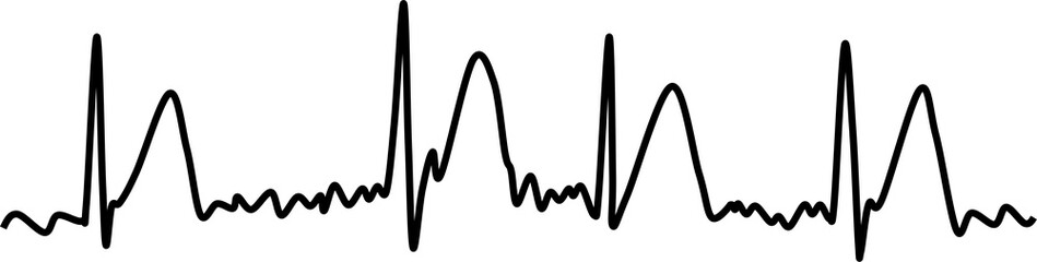 心房細動のグラフィック素材イラスト