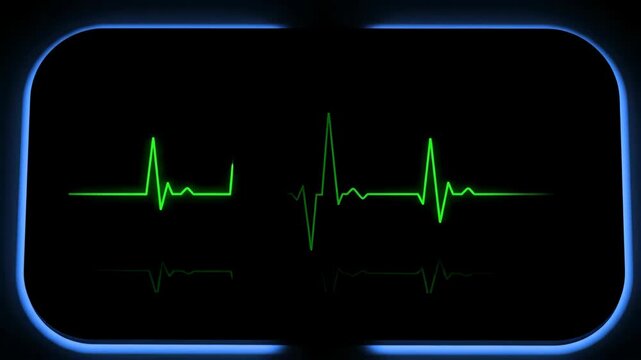 Heartbeat monitor displaying a normal electrocardiogram changing to a flatline on a monitor screen, medical animation