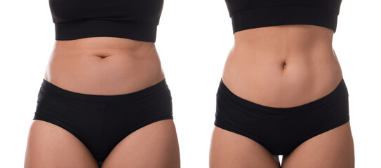 Before and after collage showing woman with good and bad posture against white background, closeup