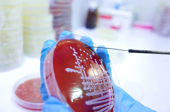 Scientist conducting microbiological experiment with petri dish