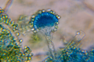 Microscopic View of a Fungal Head (Conidiophore) with Blue S © Mohammed