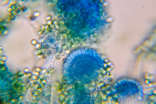 Microscopic View of a Fungal Head (Conidiophore) with Blue S